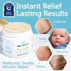 Picture of Era Organics Healing Ointment for Babies - USDA Certified Organic Natural Moisturizer Gentle on Sensitive Skin Prone To Baby Eczema, Cradle Cap (Infant Seborrheic Dermatitis), Rashes, Hives and More
