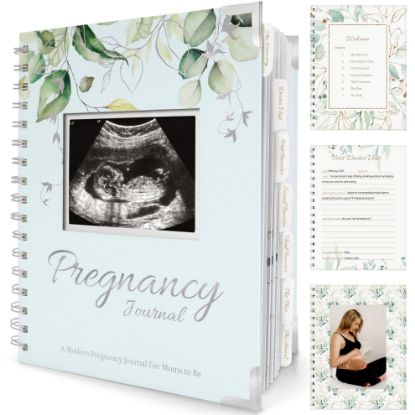 Picture of Pregnancy Journal for First Time Moms Gifts - 90 Pages Hardcover Pregnancy Memory Book, Beautiful & Cute Baby Book Keepsake, Ultrasound Baby Scrapbook, First Mother's Day Gifts (Frost)