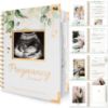 Picture of Pregnancy Journal for First Time Moms Gifts - 90 Pages Hardcover Pregnancy Memory Book, Beautiful & Cute Baby Book Keepsake, Ultrasound Baby Scrapbook, Mom To Be Gift (Alpine)