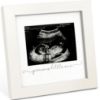 Picture of KeaBabies Baby Sonogram Picture Frame - Modern Ultrasound Picture Frames for Mom to Be, First Pregnancy Gifts for Expecting Mom & First Time Dad, Baby Gender Reveal Gifts (Alpine White)