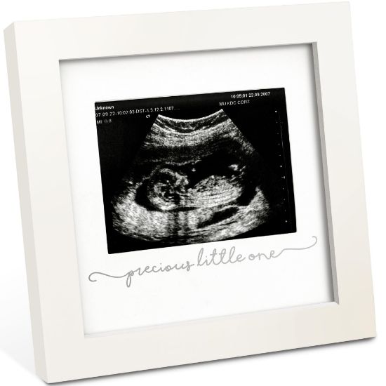 Picture of KeaBabies Baby Sonogram Picture Frame - Modern Ultrasound Picture Frames for Mom to Be, First Pregnancy Gifts for Expecting Mom & First Time Dad, Baby Gender Reveal Gifts (Alpine White)
