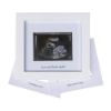Picture of IHEIPYE Baby Sonogram Photo Frame - Ultrasound Picture Frame for Expecting Parents, Baby Showers, Gender Reveal Parties, Nursery Decor (Silver Text, White)