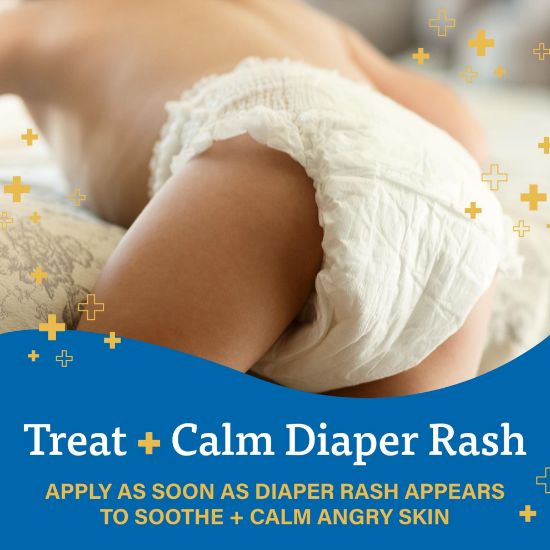MyLittleUS. A+D Zinc Oxide Diaper Rash Treatment Cream, Dimethicone 1% ...