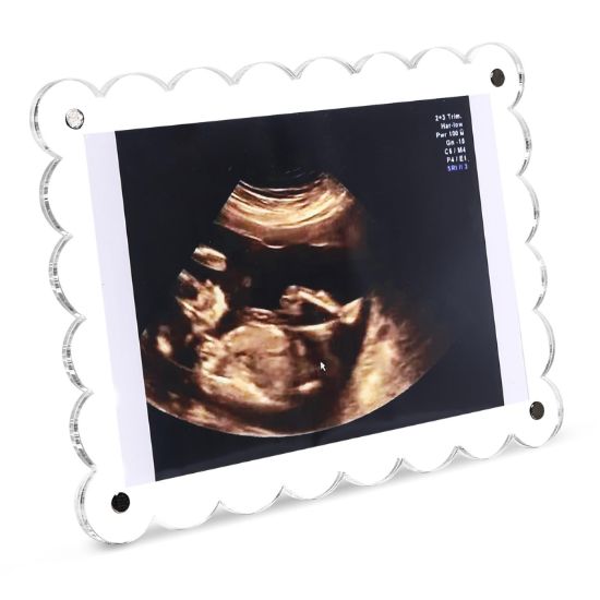 Picture of Mlatnod Magnetic Clear Acrylic Scalloped Baby Ultrasound Picture Frame - Sonogram Frame for Refrigerator, Display for Pregnancy Announcement, Gender Reveal & Expecting Parents Gifts(No Stand)